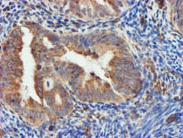 CYB5R3 / B5R Antibody (clone OTI1E8)
