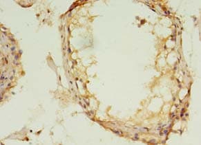 MAPK13 / p38delta Antibody