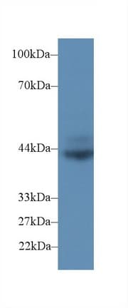 CD72 Antibody (aa126-237)