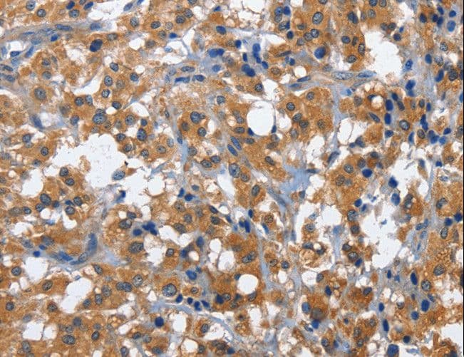 CD27 Antibody