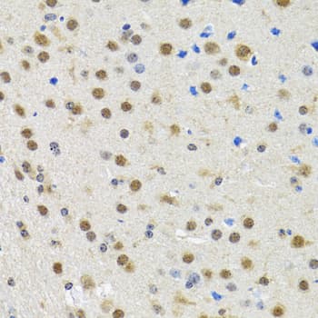 SPIN / SPIN1 Antibody
