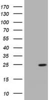 KRAS Antibody (clone OTI1D1)