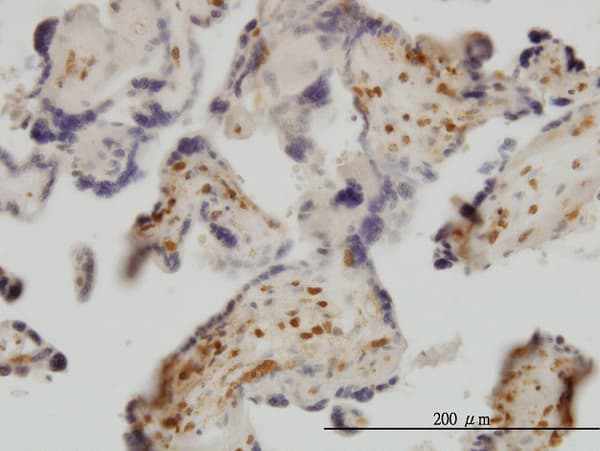 EXOSC8 Antibody (clone 1G5)