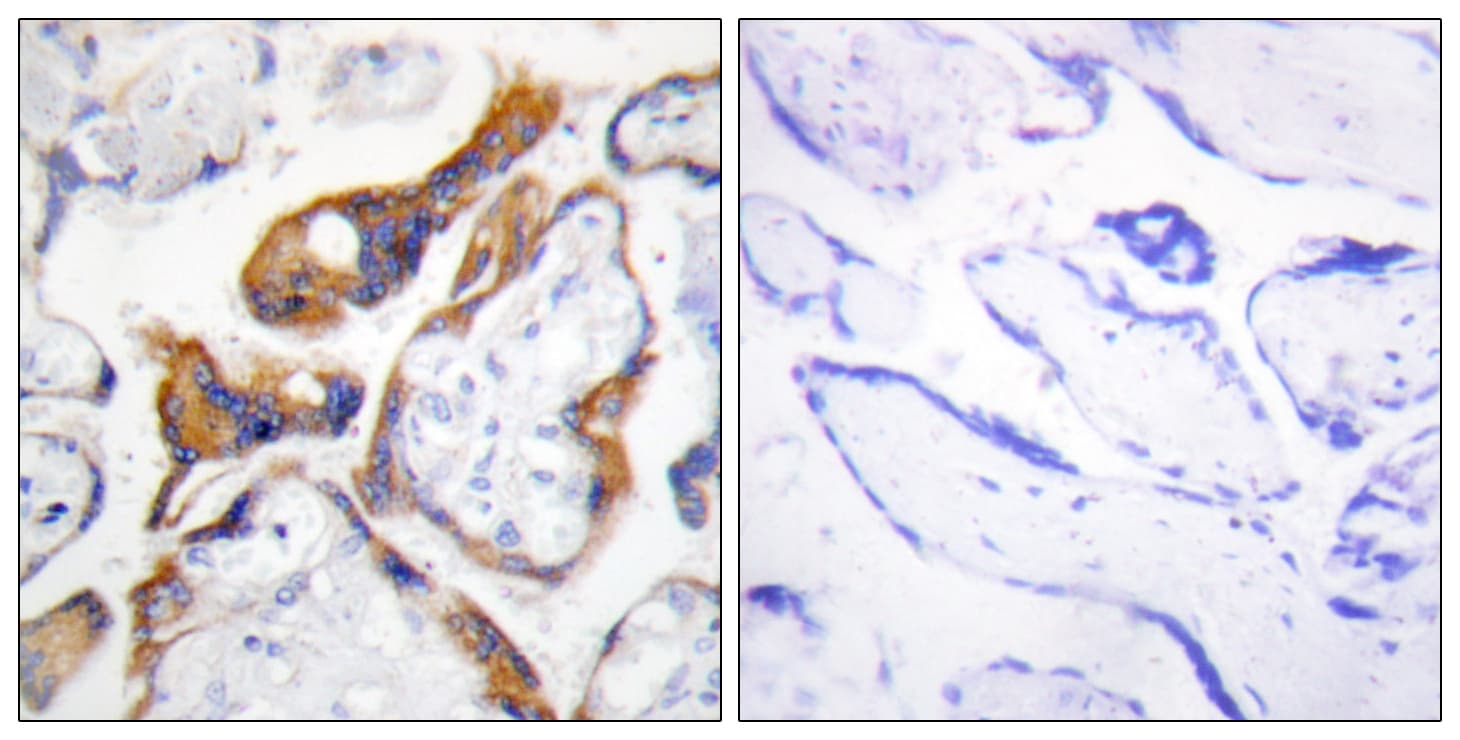 Polyclonal Rabbit anti-Human PHLDA2 / TSSC3 Antibody (aa81-130, IHC)