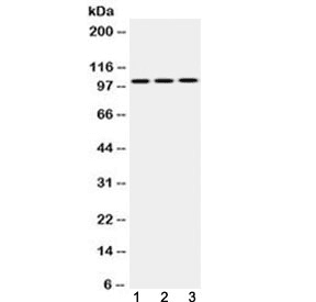 HK2 / Hexokinase 2 Antibody