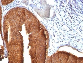 KRT19 / CK19 / Cytokeratin 19 Antibody (clone KRT19/800)