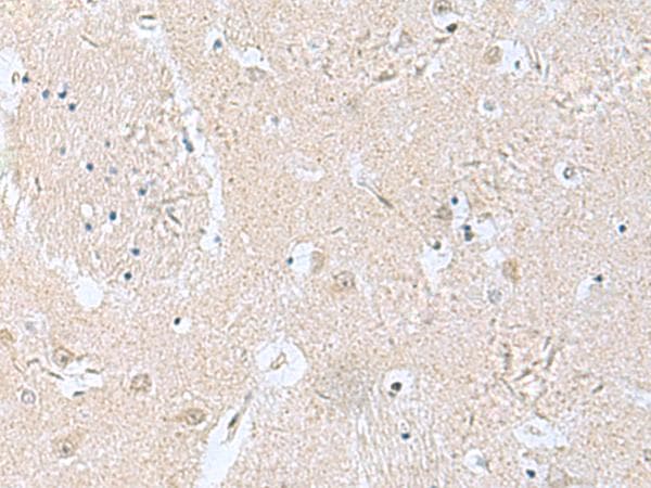 Polyclonal Rabbit anti-Human TPD52L3 Antibody (IHC)