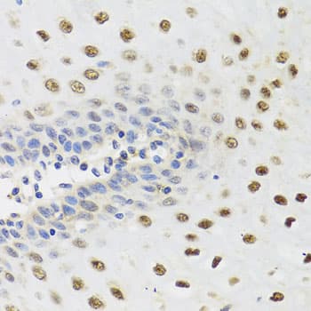 Polyclonal Rabbit anti-Human YTHDF3 Antibody (IHC, WB)