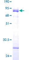 Human COL9A1 / Collagen IX Protein (Recombinant GST)