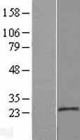 MOSPD1 Protein (Over-Expression Lysate Myc-DDK (Flag))