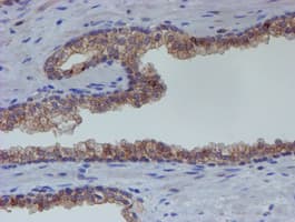 ER Alpha / Estrogen Receptor Antibody (clone OTI1B1)