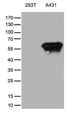 TRIM29 Antibody (aa1-352, clone OTI5C11)