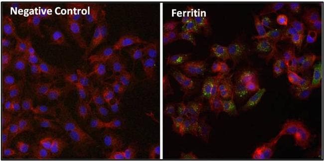 Ferritin Antibody (clone 523)