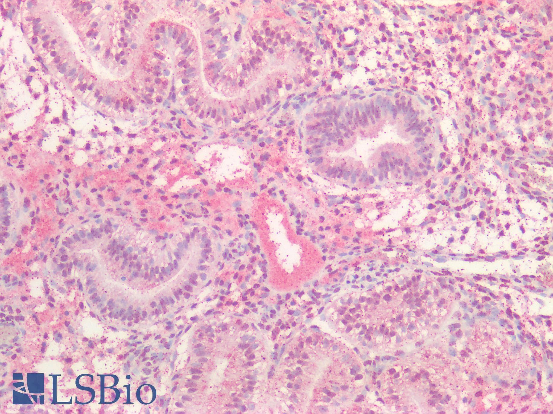 IHC-plus™ Polyclonal Rabbit anti-Human EBI3 / IL-27B Antibody (IHC)