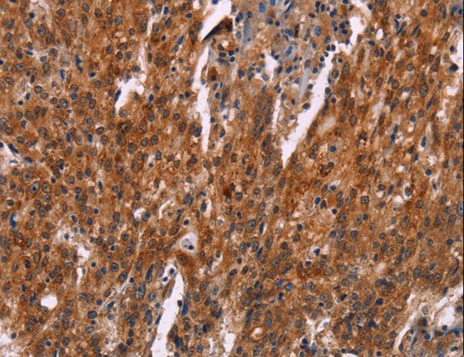 HSPB6 / HSP20 Antibody