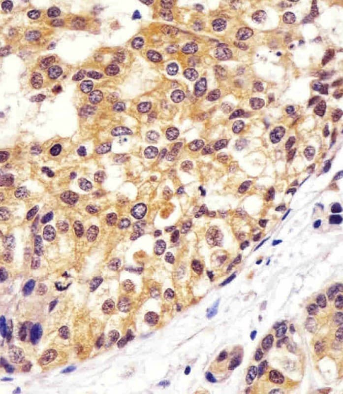 VCP Antibody (clone 1563CT163.48.77)