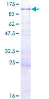 Human CENPC / CENP-C Protein (Recombinant GST)