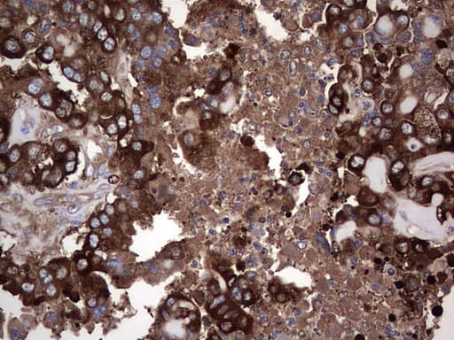 GARS / Glycyl tRNA Synthetase Antibody (clone OTI4G4)