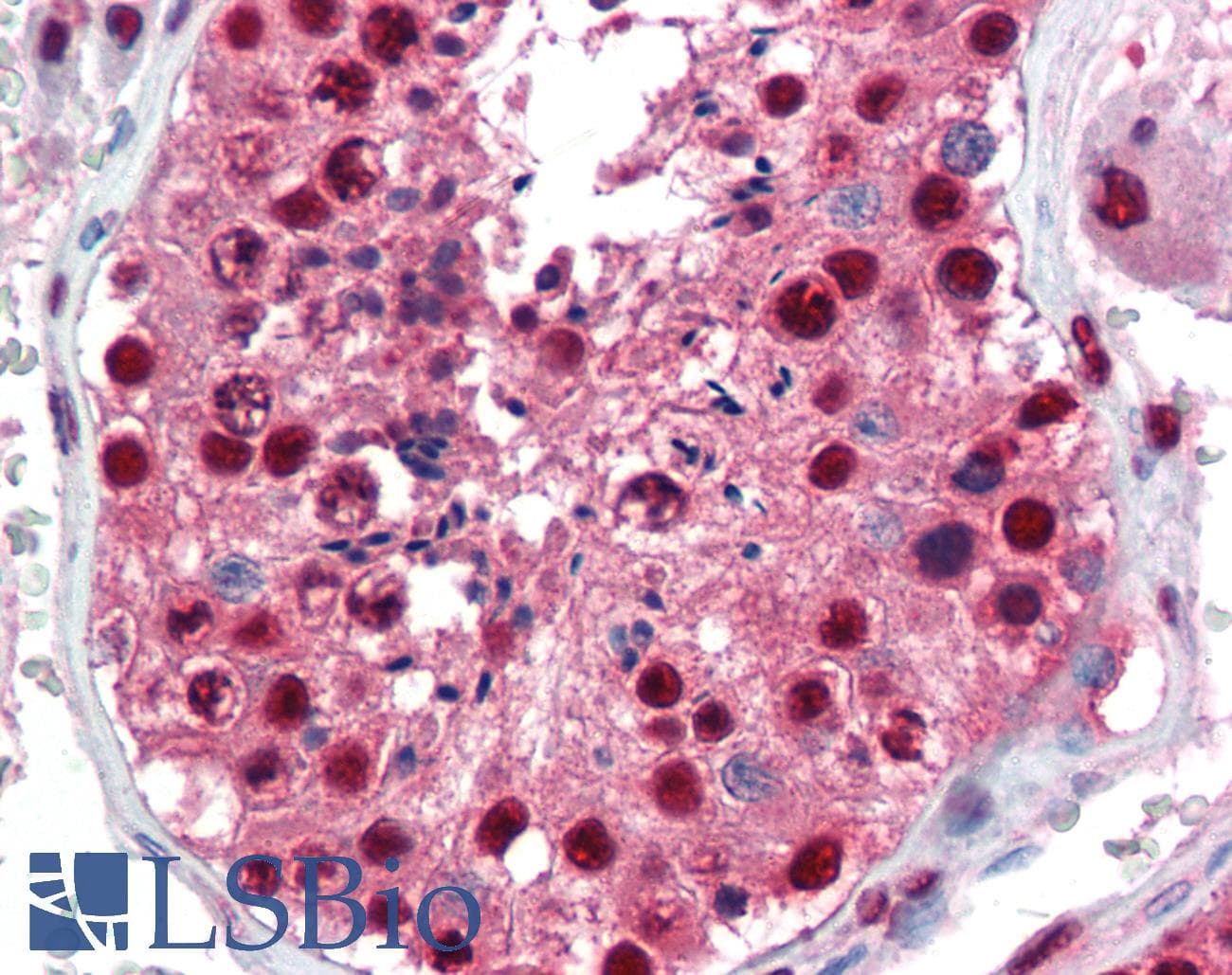 PathPlus™ Polyclonal Rabbit anti-Human PAX7 Antibody (aa167-216, IHC, WB)