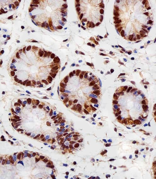 Polyclonal Rabbit anti-Human RBX1 / ROC1 Antibody (aa74-108, IHC, IF, WB)