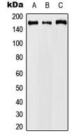 CCNB3 / Cyclin B3 Antibody (Internal)