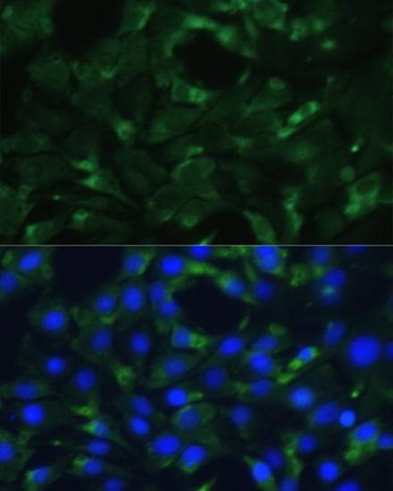 ENO1 / Alpha Enolase Antibody