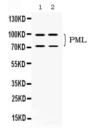 Polyclonal Rabbit anti-Human PML Antibody (IHC, WB)