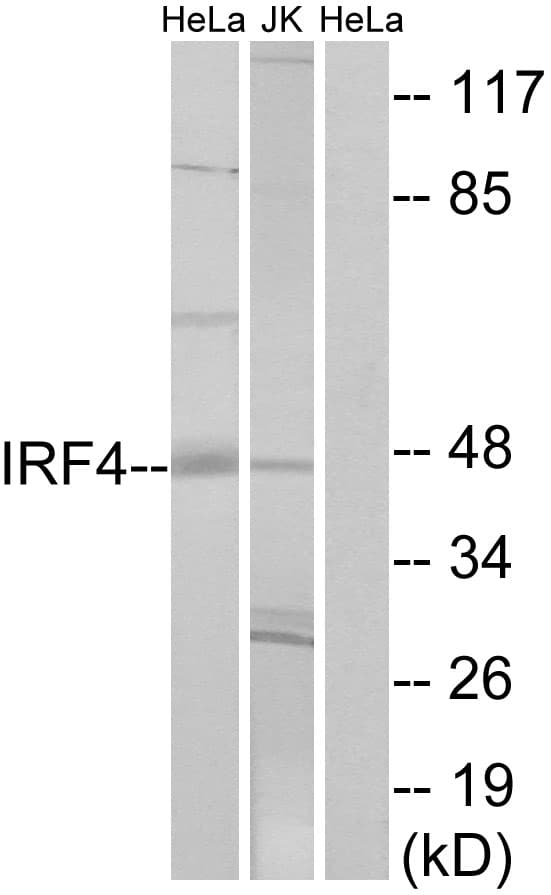 Polyclonal Rabbit anti-Human IRF4 Antibody (aa281-330, WB)