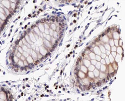IKBKB / IKK2 / IKK Beta Antibody (phospho-Tyr199)