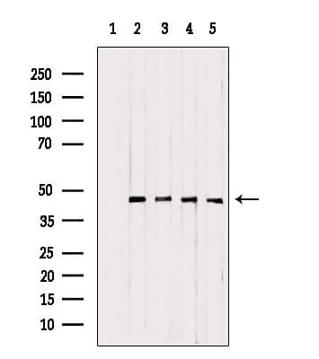 Polyclonal Rabbit anti-Human UQCRC1 Antibody (IHC, IF, WB)