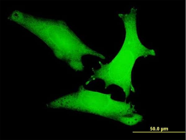 Monoclonal Mouse anti-Human AXIN1 / Axin-1 Antibody (clone 2B11, IF, WB)