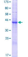Human GLIPR1L1 Protein (Recombinant GST)