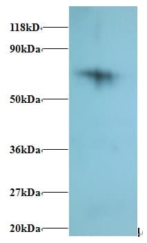 RPS18 / Ribosomal Protein S18 Antibody