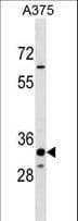 THEM5 Antibody (aa71-99)
