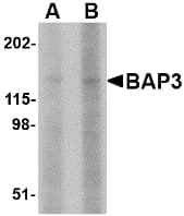 Polyclonal Rabbit anti-Human BAIAP3 Antibody (IHC, WB)
