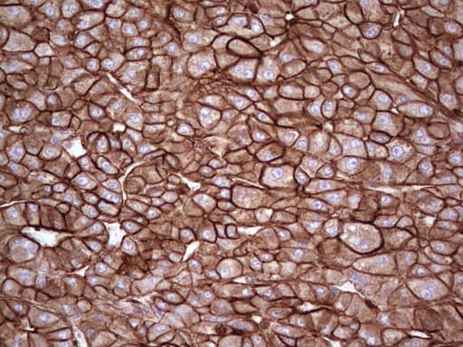 LGALS9 / Galectin 9 Antibody (clone OTI1D12)