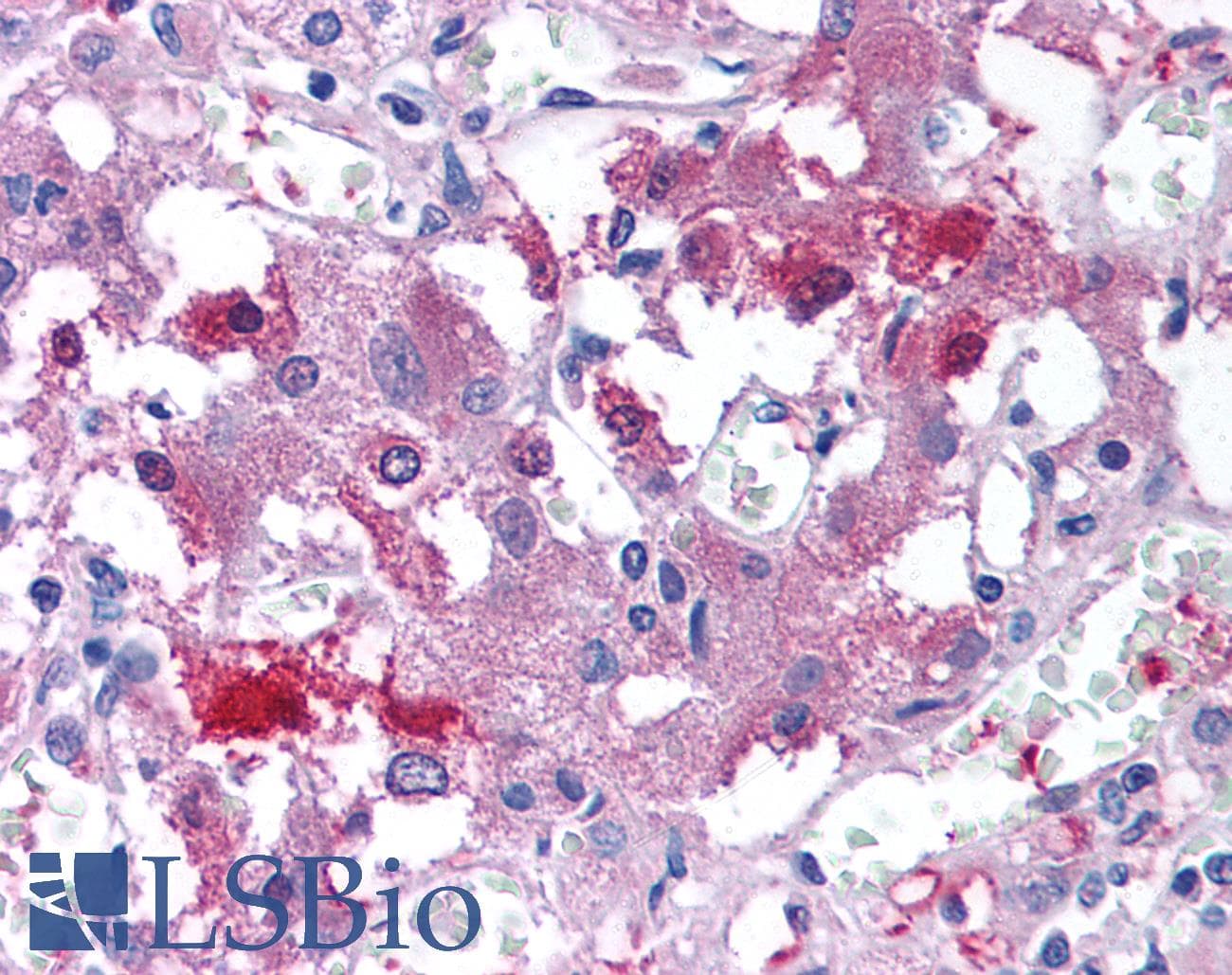 IHC-plus™ USP20 / VDU2 Antibody (Internal)