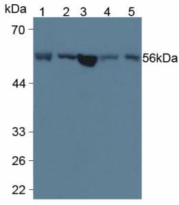 MBOAT5 / C3F Antibody (aa122-233, Cy3)
