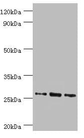 Polyclonal Rabbit anti-Human AZU1 / Azurocidin Antibody (aa27-251, IHC, WB)