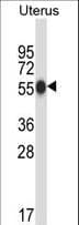 Carboxypeptidase O / CPO Antibody (aa46-75)