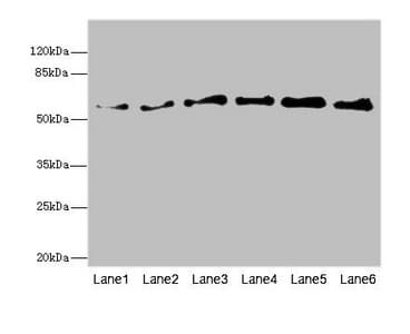 Polyclonal Rabbit anti-Human PIP5K1B Antibody (IHC, WB)