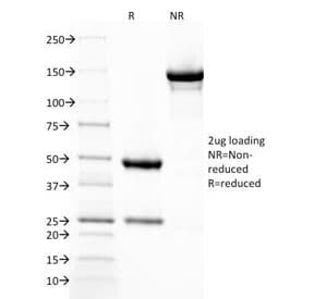 Monoclonal Mouse anti-Human THBD / CD141 / Thrombomodulin Antibody (clone THBD/1782, IHC, IF)