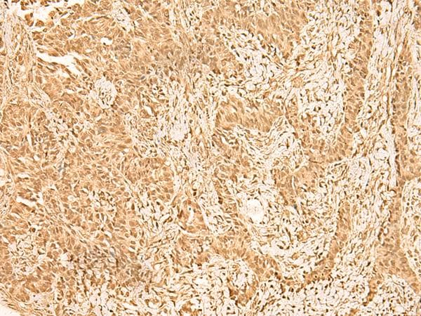 ZNF471 Antibody