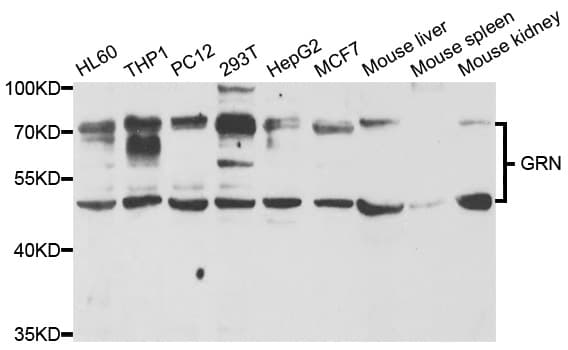 IHC-plus™ GRN / Granulin Antibody