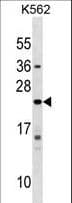 IFNA10 / Interferon Alpha 10 Antibody (aa162-189)