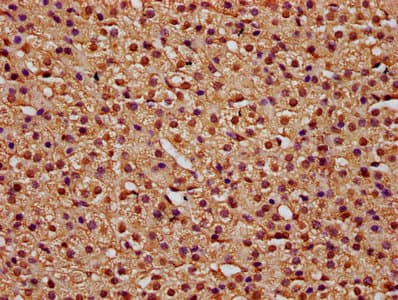 Polyclonal Rabbit anti-Human TTI2 / C8orf41 Antibody (IHC, IF, WB)