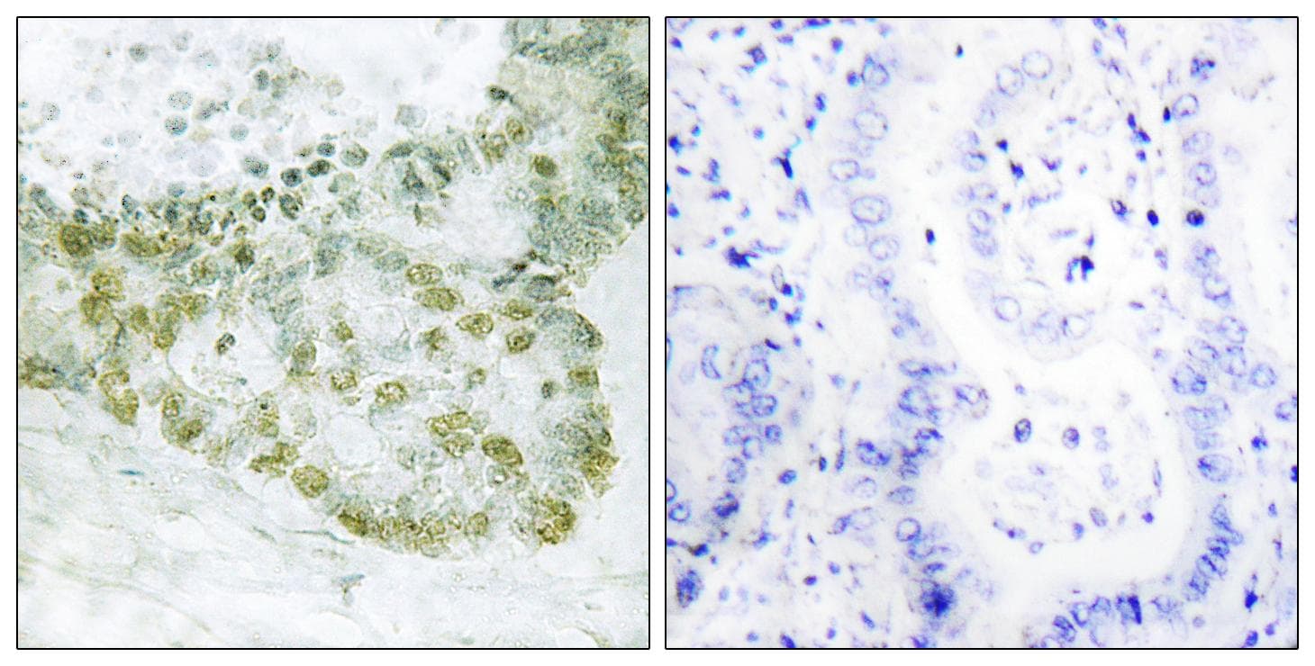 ARA55 / HIC-5 Antibody (Ab-60)