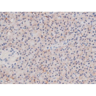 ADD1 / Adducin Alpha Antibody (phospho-Ser726)