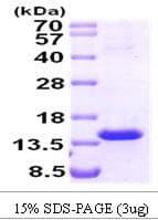 Human TCL1A / TCL1 Protein (Recombinant)