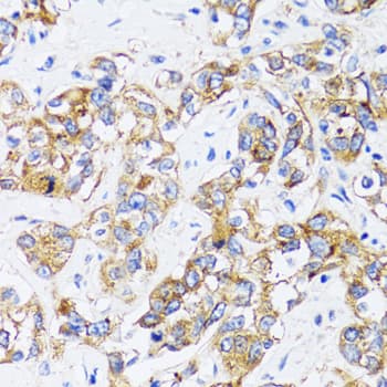 CD71 / Transferrin Receptor Antibody